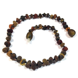 Baltic Amber Asteroid - 9.5 Anklet - Baltic Amber Jewelry