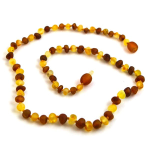 Baltic Amber Nutmeg & Lemondrop - 16 Necklace - Baltic Amber Jewelry