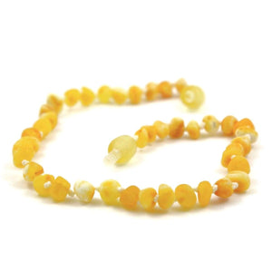 Baltic Amber Super Butter - 9.5 Anklet - Baltic Amber Jewelry