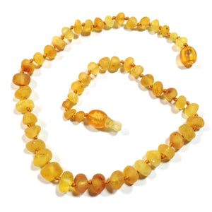 Baltic Amber Lemondrop - 12 Necklace - Pop Clasp - Baltic Amber Jewelry